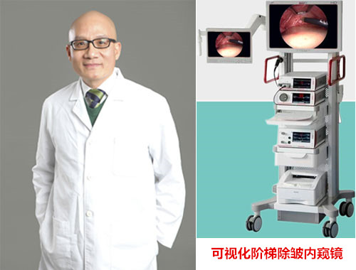北医三院谢宏彬面部除皱好吗