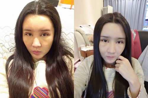 上海华美整形案例