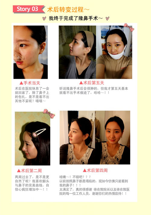 要做鼻子整形,哪家整形医院鼻子整形做的最好