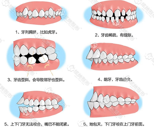 18岁后还能做牙齿矫正吗