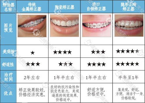 炫美网 牙齿整形 牙齿矫正 正文 根据国内多位专业口腔科医生说