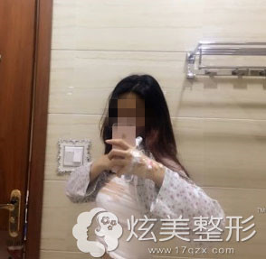 丰胸日记我在重庆军美整形自体脂肪隆胸后1个月恢复全过程