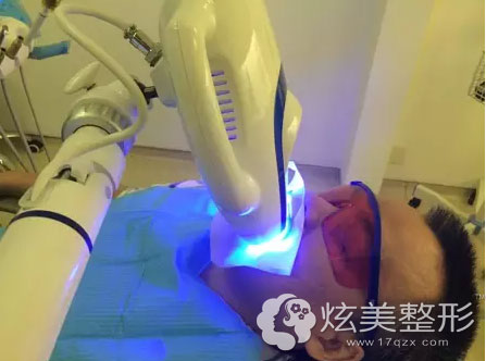 真人自述看我在广州和睦家做牙齿冷光美白全过程