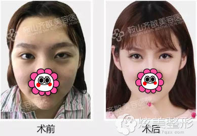 对自己眼睛不满意的同学,如今青春时尚的学生们已经不能满足于仅仅把