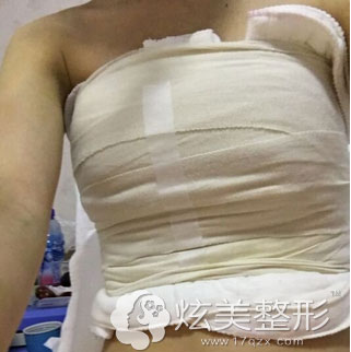 什么是水滴状乳房 20170825030433585.jpg