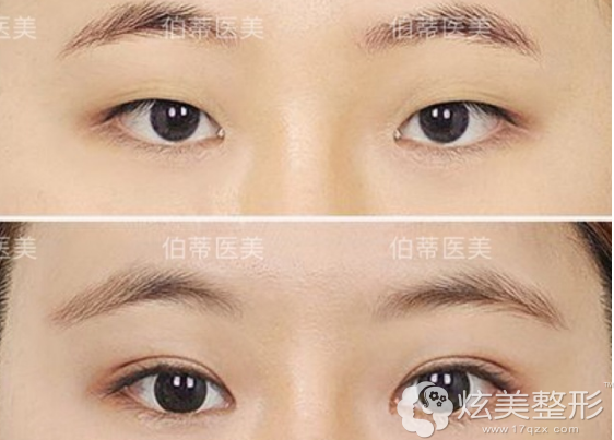 双眼皮三点定位的原理_图:基站\