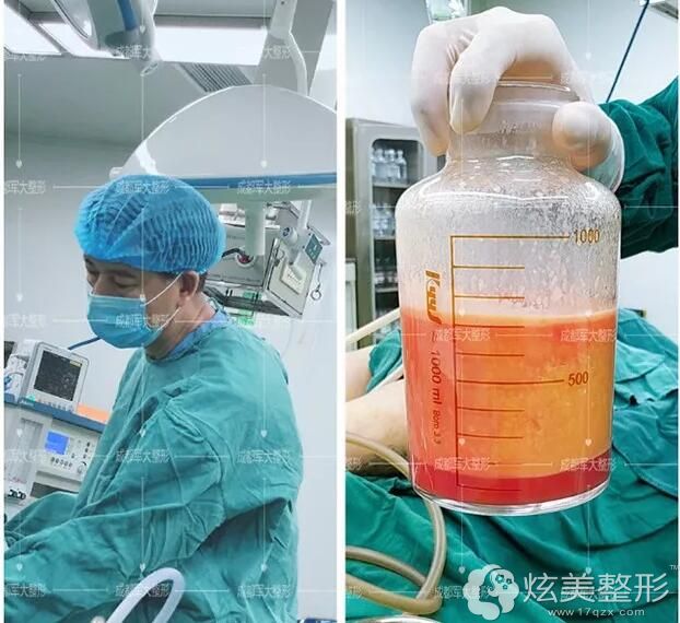 有人瘦了6斤,而我却瘦了8斤