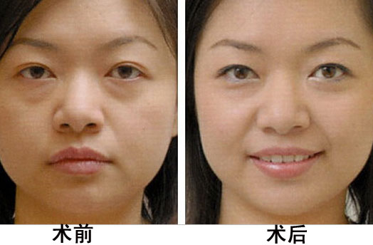 黑脸娃娃的效果图