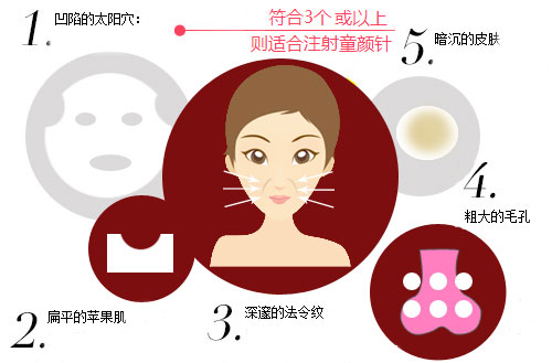 童颜针注射过量怎么办