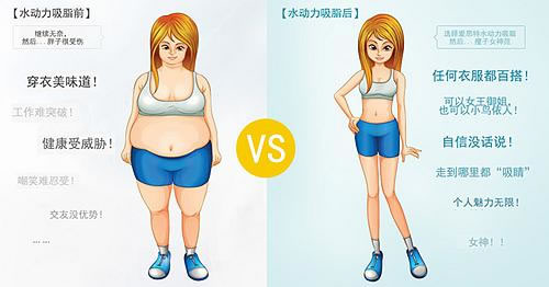 水动力吸脂减肥前后对比