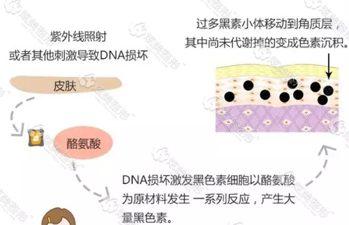 夏天晒黑了怎么白回来 - 美白 - 炫美网