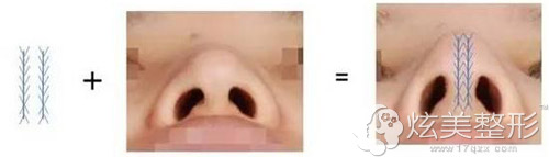�ߵ�¡��Ч�����ߵ�¡����ά�ֶ��