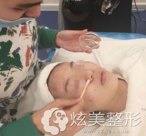 第六步:果酸焕肤 第六步:果酸焕肤