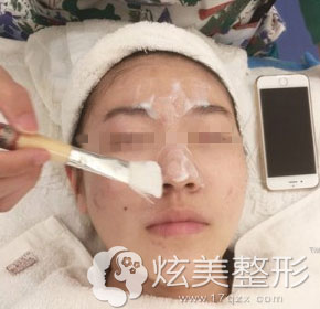 第七步:稀释果酸 第七步:稀释果酸