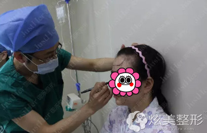 医生术前将脸部进行精细的划分 医生术前将脸部进行精细的划分