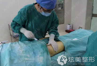 先进行抽取脂肪手术 先进行抽取脂肪手术