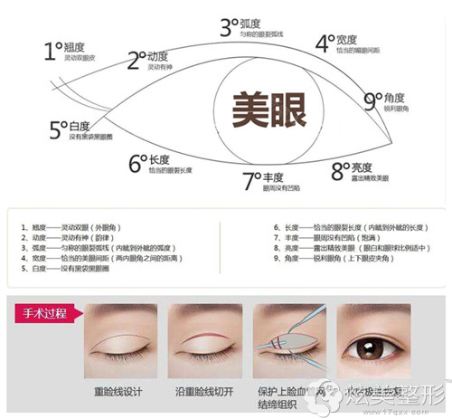 宁波徐建国整形好不好想要自然无痕双眼皮效果可以吗