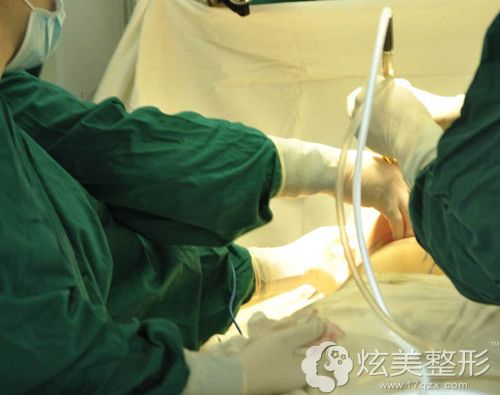 李俊明医生假体隆胸手术中