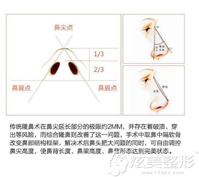 鼻梁高度怎么测量,鼻梁长度怎么测量,鼻梁高的标准是什么_大山谷图库