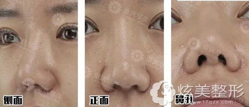 ¡ʧ޸ʵ컪¡Ч