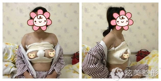 ���������ˮ�μ���¡�ػָ�