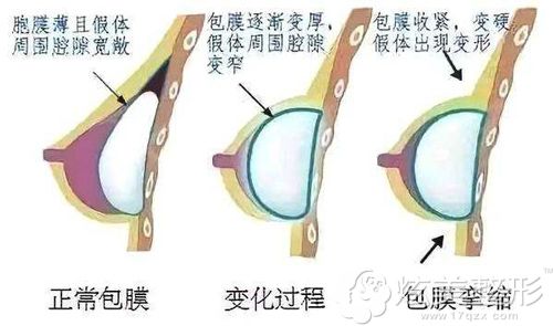 ¡غӲȡ?׼컪޸