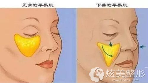 70ȧ֬桰ˡ?˵Цÿ