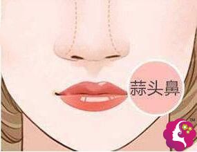 36ͷʴݱͷСô