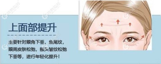 �Ͼ���ҿ��׵Ļ����������沿С�п���Ƥ�����ö���Ǯ