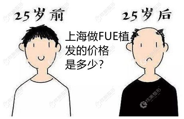 뿴FUEֲļ۸ԴҽԺշѱ˽⵽