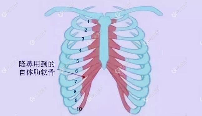 肋骨隆鼻中取肋软骨的具体部位