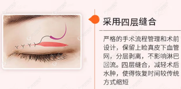 白永辉医生除了做眼修复用的四层缝合技术